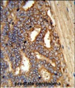alpha Amylase 1 Polyclonal Antibody:Antibodies, Polyclonal