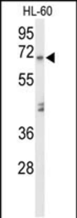 alpha Amylase 1 Polyclonal Antibody:Antibodies, Polyclonal