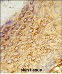 LDHA Polyclonal Antibody:Antibodies, Polyclonal