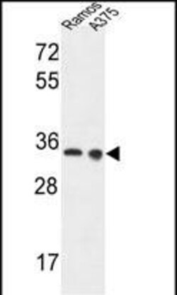 LDHA Polyclonal Antibody:Antibodies, Polyclonal