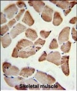 LFNG Polyclonal Antibody:Antibodies, Polyclonal