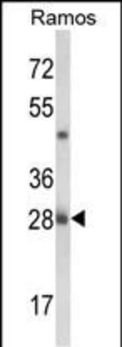 NUCKS1 Polyclonal Antibody:Antibodies, Polyclonal