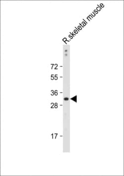 Invitrogen DIO3 Polyclonal Antibody 400 &mu;L; Unconjugated:Antibodies,