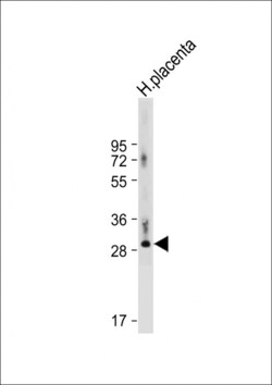 Invitrogen DIO3 Polyclonal Antibody 400 &mu;L; Unconjugated:Antibodies,