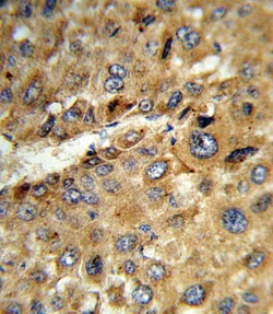 Invitrogen TAT Polyclonal Antibody 400 &mu;L; Unconjugated:Antibodies,