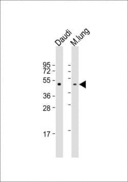 Invitrogen TAT Polyclonal Antibody 400 &mu;L; Unconjugated:Antibodies,