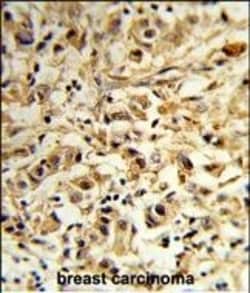 Invitrogen MAT2B Polyclonal Antibody 400 &mu;L; Unconjugated:Antibodies,