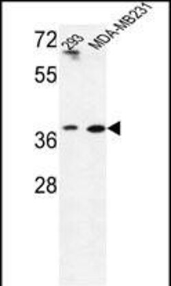 Invitrogen MAT2B Polyclonal Antibody 400 &mu;L; Unconjugated:Antibodies,