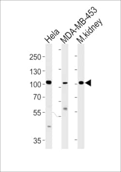 Invitrogen NCOA7 Polyclonal Antibody 400 &mu;L | Buy Online | Invitrogen&trade; | Fisher Scientific