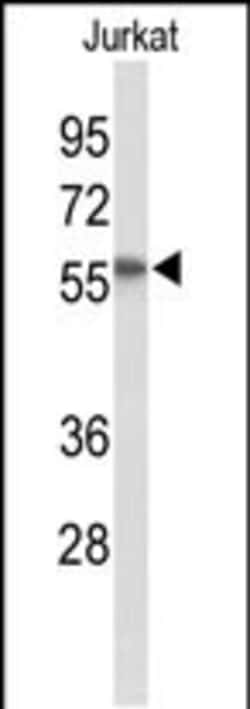Invitrogen SACM1L Polyclonal Antibody 400 &mu;L; Unconjugated:Antibodies,