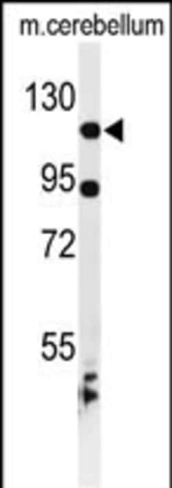 Invitrogen KIF6 Polyclonal Antibody 400 &mu;L; Unconjugated:Antibodies,