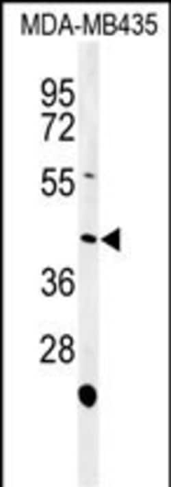 NOXA1 Polyclonal Antibody:Antibodies, Polyclonal