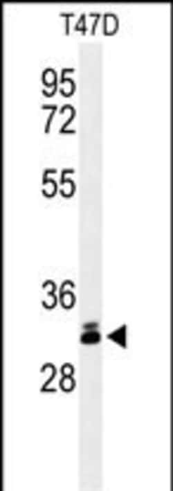 Invitrogen DKK1 Polyclonal Antibody 400 μL; Unconjugated:Antibodies,