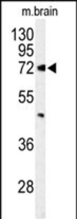 Invitrogen ABCD2 Polyclonal Antibody 400 &mu;L; Unconjugated:Antibodies,