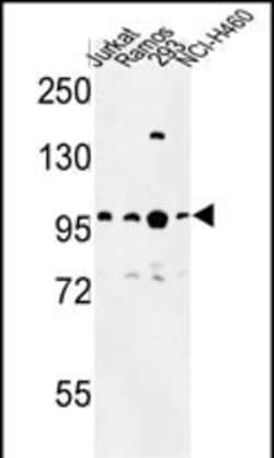 Invitrogen BCL11A Polyclonal Antibody 400 &mu;L; Unconjugated:Antibodies,