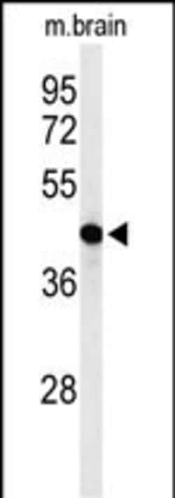 Invitrogen AGPAT6 Polyclonal Antibody 400 &mu;L; Unconjugated:Antibodies,