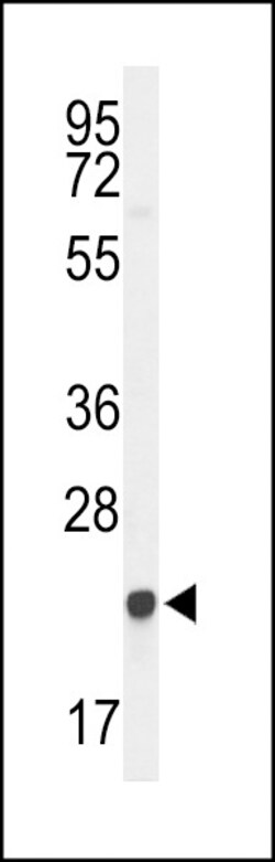 Invitrogen GGCT Polyclonal Antibody 400 &mu;L; Unconjugated:Antibodies,