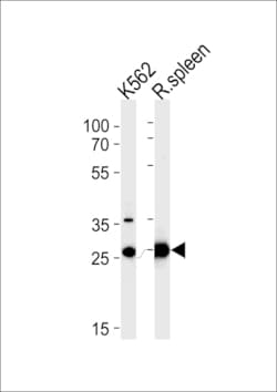Invitrogen SLC25A37 Polyclonal Antibody 400 &mu;L | Buy Online | Invitrogen&trade; | Fisher Scientific