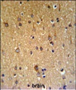 Invitrogen ZDHHC9 Polyclonal Antibody 400 &mu;L; Unconjugated:Antibodies,