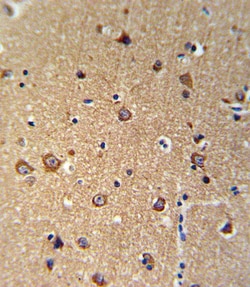 Invitrogen ANKH Polyclonal Antibody 400 μL; Unconjugated:Antibodies,