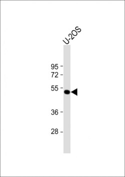 Invitrogen ANKH Polyclonal Antibody 400 μL; Unconjugated:Antibodies,