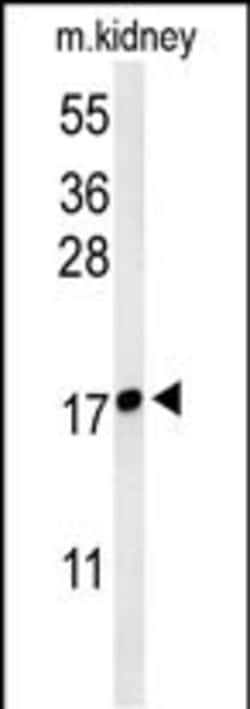 Invitrogen LYPD1 Polyclonal Antibody 400 &mu;L; Unconjugated:Antibodies,