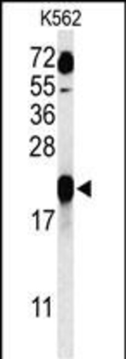 Invitrogen GAGE7 Polyclonal Antibody 400 &mu;L; Unconjugated:Antibodies,
