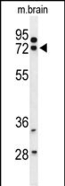 Invitrogen HSPA12A Polyclonal Antibody 400 &mu;L; Unconjugated:Antibodies,
