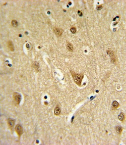 Invitrogen ST8SIA4 Polyclonal Antibody 400 &mu;L; Unconjugated:Antibodies,