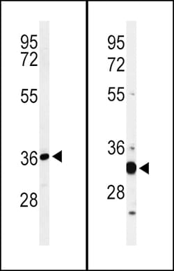 Invitrogen ST8SIA4 Polyclonal Antibody 400 &mu;L; Unconjugated:Antibodies,