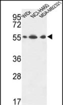 Invitrogen ATP5A1 Polyclonal Antibody 400 &mu;L; Unconjugated:Antibodies,