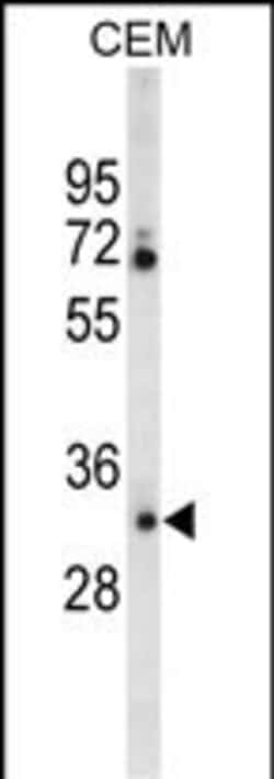 Invitrogen Carbonic Anhydrase VI Polyclonal Antibody 400 &mu;L; Unconjugated:Antibodies,