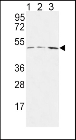 Invitrogen HAPLN1 Polyclonal Antibody 400 &mu;L | Buy Online | Invitrogen&trade; | Fisher Scientific