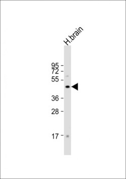 Invitrogen FOXG1 Polyclonal Antibody 400 &mu;L; Unconjugated:Antibodies,
