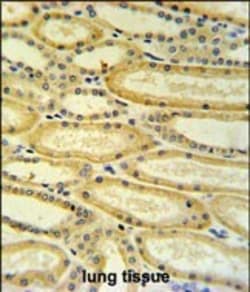 Invitrogen HSD17B11 Polyclonal Antibody 400 &mu;L; Unconjugated:Antibodies,
