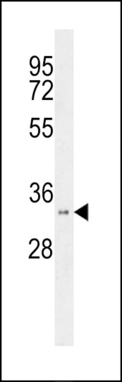 Invitrogen HSD17B11 Polyclonal Antibody 400 &mu;L; Unconjugated:Antibodies,