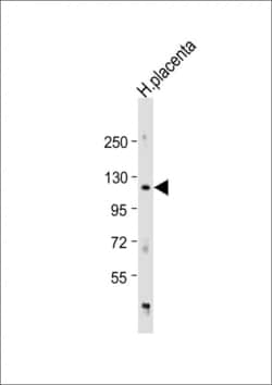 Invitrogen ADAM19 Polyclonal Antibody 400 &mu;L; Unconjugated:Antibodies,