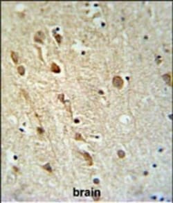 Invitrogen ZRANB1 Polyclonal Antibody 400 &mu;L | Buy Online | Invitrogen&trade; | Fisher Scientific