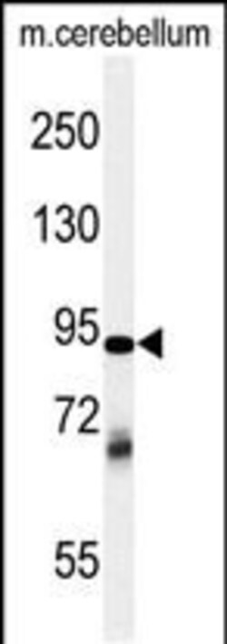Invitrogen ZRANB1 Polyclonal Antibody 400 &mu;L | Buy Online | Invitrogen&trade; | Fisher Scientific