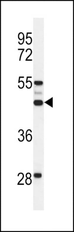 Invitrogen™ SLC51A Polyclonal Antibody