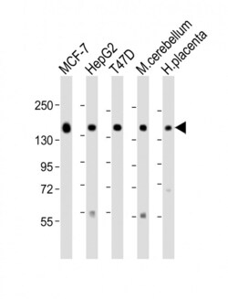 Invitrogen GLG1 Polyclonal Antibody 400 &mu;L; Unconjugated:Antibodies,