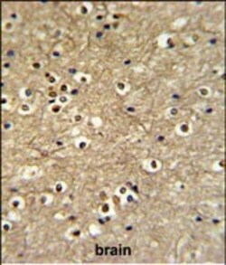 Invitrogen ETS2 Polyclonal Antibody 400 &mu;L; Unconjugated:Anticuerpos