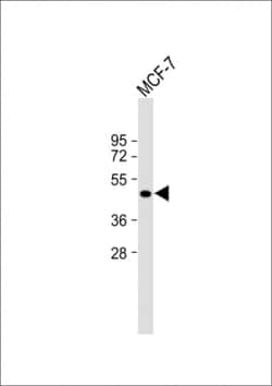 Invitrogen ETS2 Polyclonal Antibody 400 &mu;L; Unconjugated:Anticuerpos