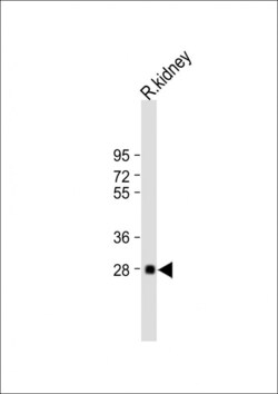Invitrogen BSND Polyclonal Antibody 400 &mu;L; Unconjugated:Antibodies,