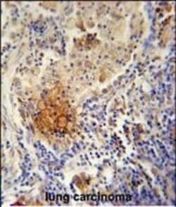 Invitrogen TYROBP Polyclonal Antibody 400 &mu;L; Unconjugated:Antibodies,
