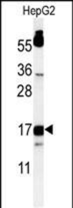 Invitrogen TYROBP Polyclonal Antibody 400 &mu;L; Unconjugated:Antibodies,