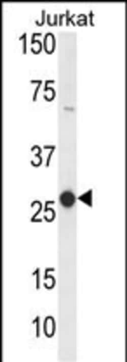 Invitrogen CD160 Polyclonal Antibody 400 μL; Unconjugated:Antibodies,