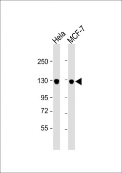 Invitrogen GTSE1 Polyclonal Antibody 400 &mu;L; Unconjugated:Antibodies,