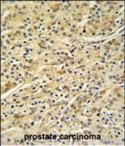 Invitrogen HOXA3 Polyclonal Antibody 400 &mu;L; Unconjugated:Antibodies,