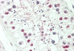 Invitrogen HOXA3 Polyclonal Antibody 400 &mu;L; Unconjugated:Antibodies,